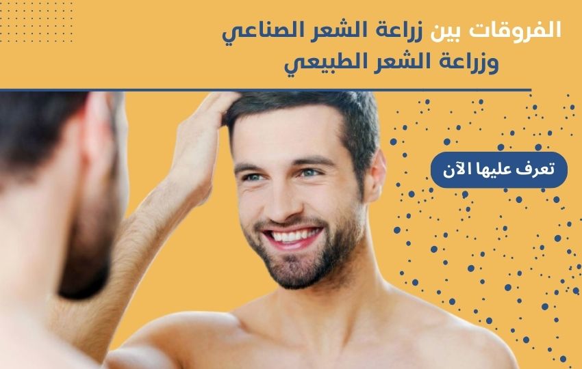 صورة تصميمية لمقال زراعة الشعر , رجل مبتسم بعد زراعة شعر ناجحة